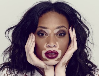Un autre regard sur le vitiligo